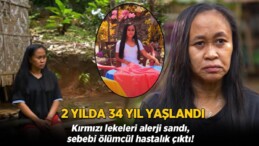 2 senede 34 yıl yaşlandı! Kırmızı lekeleri alerji sandı, sebebi ölümcül çıktı