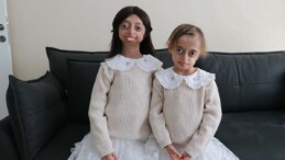 Progeria ile mücadele eden kardeşler hayata umutlu bakıyor