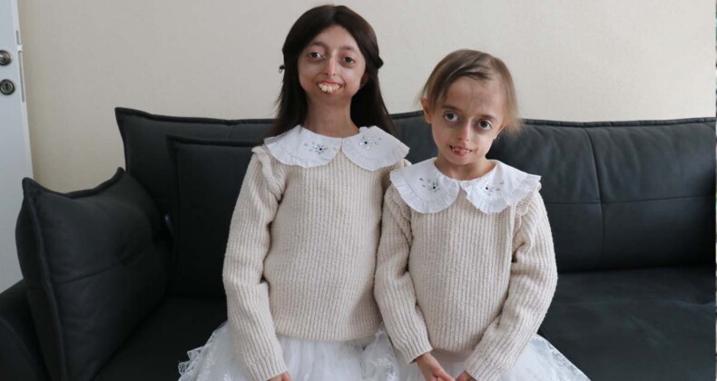 Progeria ile mücadele eden kardeşler hayata umutlu bakıyor